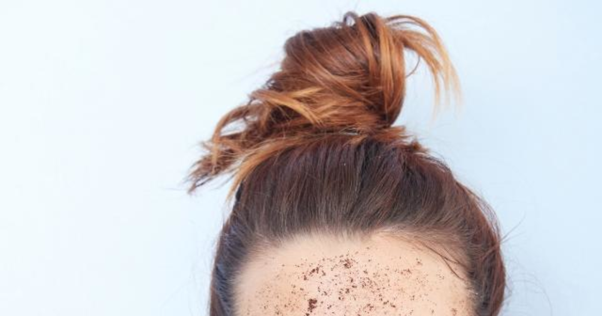 Peeling Vs. Scrub The real truth for those who want to know GirlsAskGuys