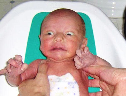 Reasons Why I Find Babies Visually Unappealing