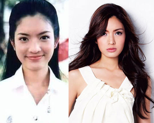 My Thoughts on Plastic Surgery