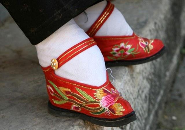 10 Dangerous Fashion Trends Through History