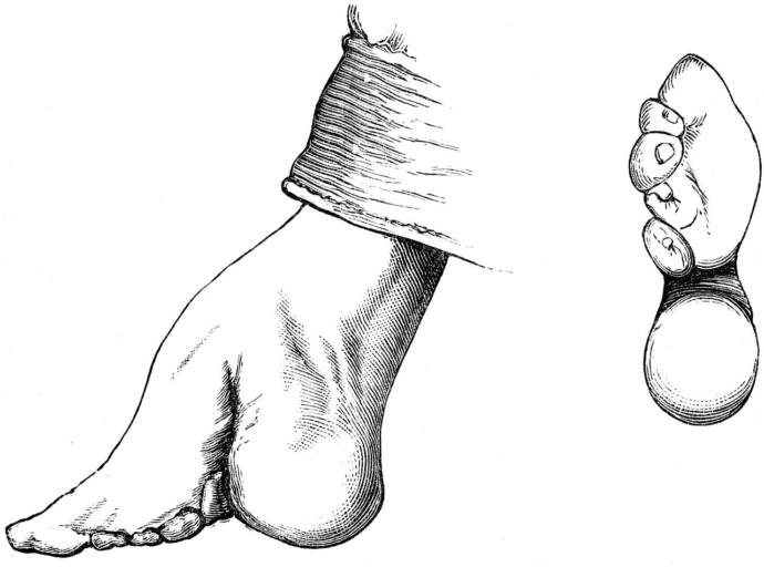 10 Dangerous Fashion Trends Through History