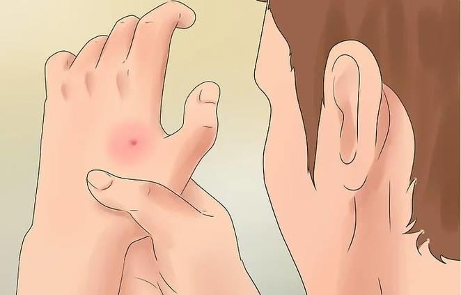 Problems We Long Term Nail Biters Face