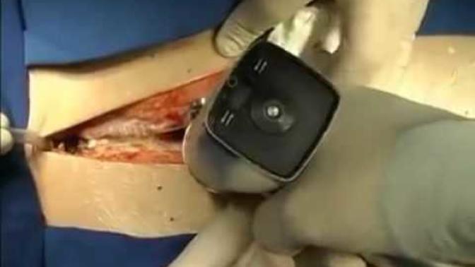 5 of My Favorite Surgeries To Watch