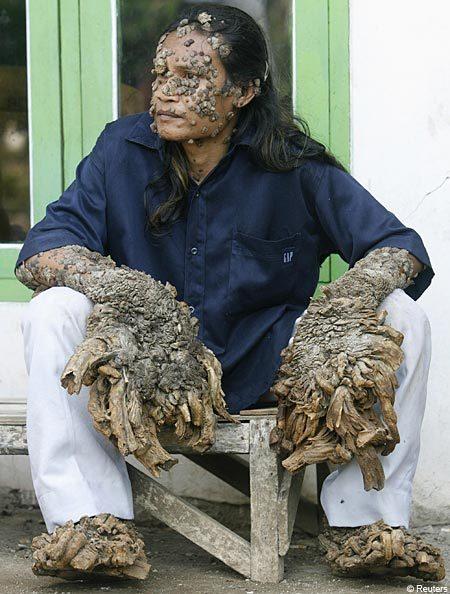 Some of the Worlds Most Extraordinary People (Part 2)