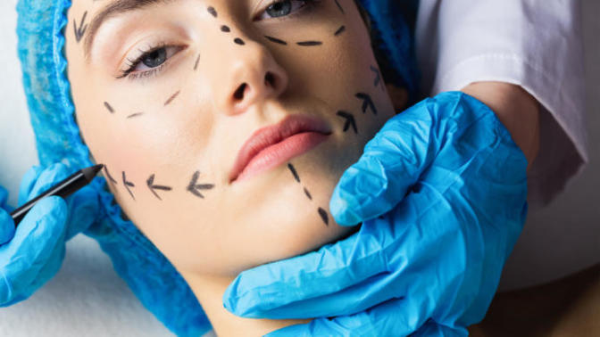 What it's Like Getting Facial Feminization Surgery