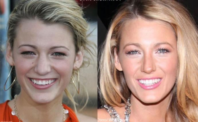 Celebrity Make-Overs
