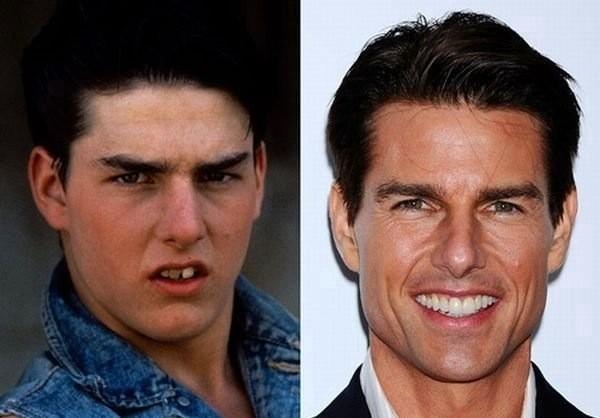 Celebrity Make-Overs