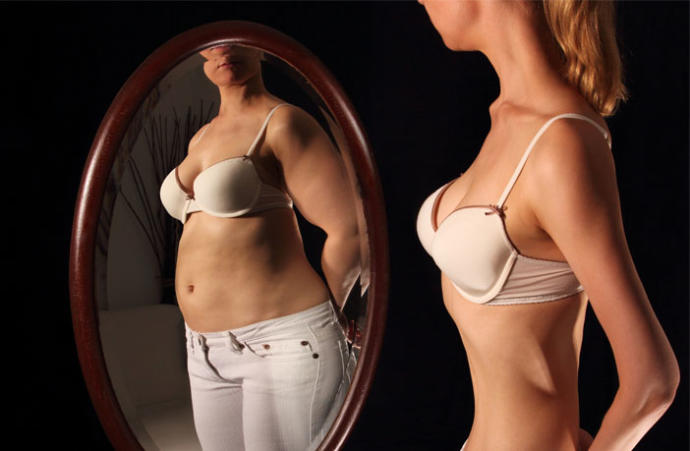 My Experience with Anorexia Nervosa...