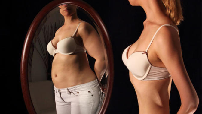 My Experience with Anorexia Nervosa...