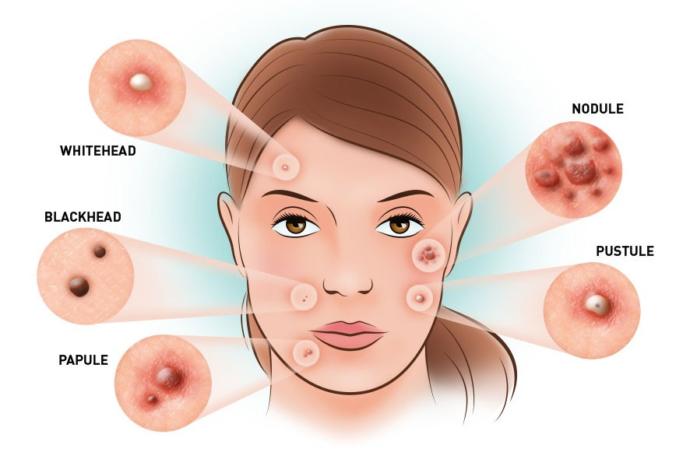 What Skin Reactions are Your Emotions Triggering?
