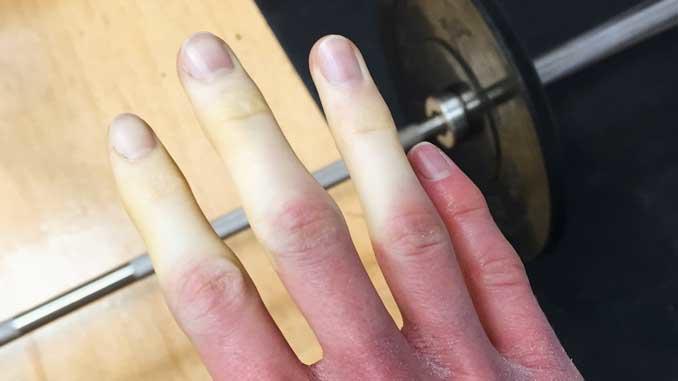 What Skin Reactions are Your Emotions Triggering?
