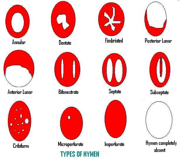 The Hymen And Your First Time You Do Not Have To Feel Pain Or Bleed 