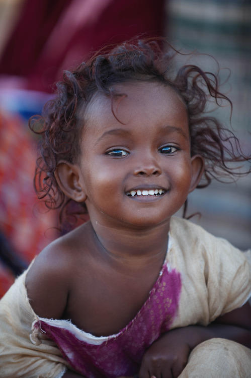 Phenotype of the Horn of Africa