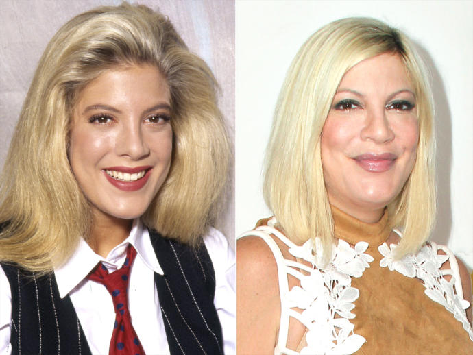 The Original Cast Of Beverly Hills 90210 Series: What They Look Like Now