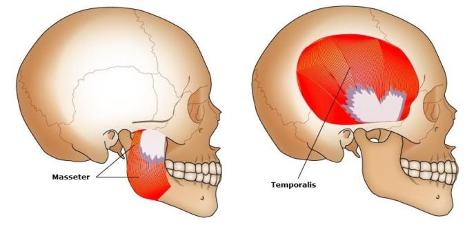 Left: The masseter connects the angle of the lower jaw with the back of the cheek bone (an area called the