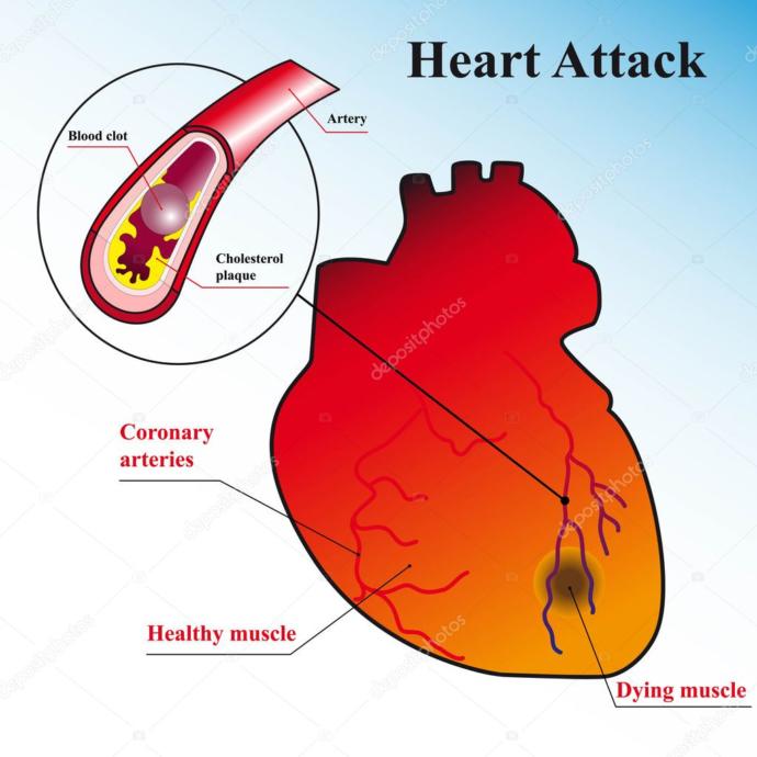 The Truth about heart medication...