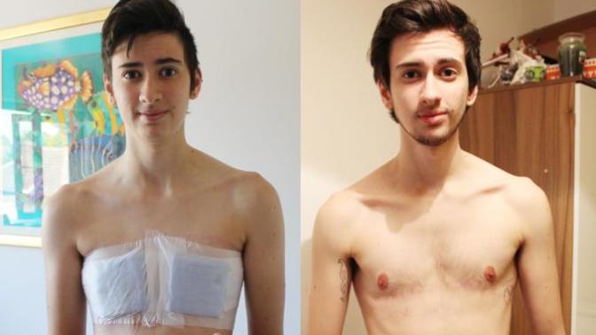 Why I Am Becoming A Transgender