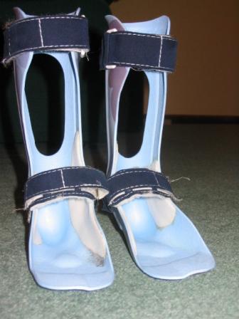 Diplegia: What It Is and How It Has Affected Me.