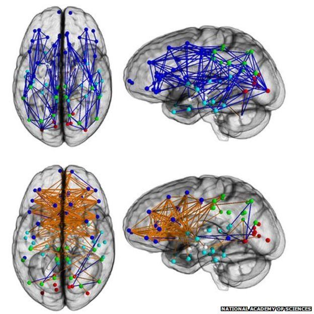 Up: male, down: female. Hormones influence brain structure.