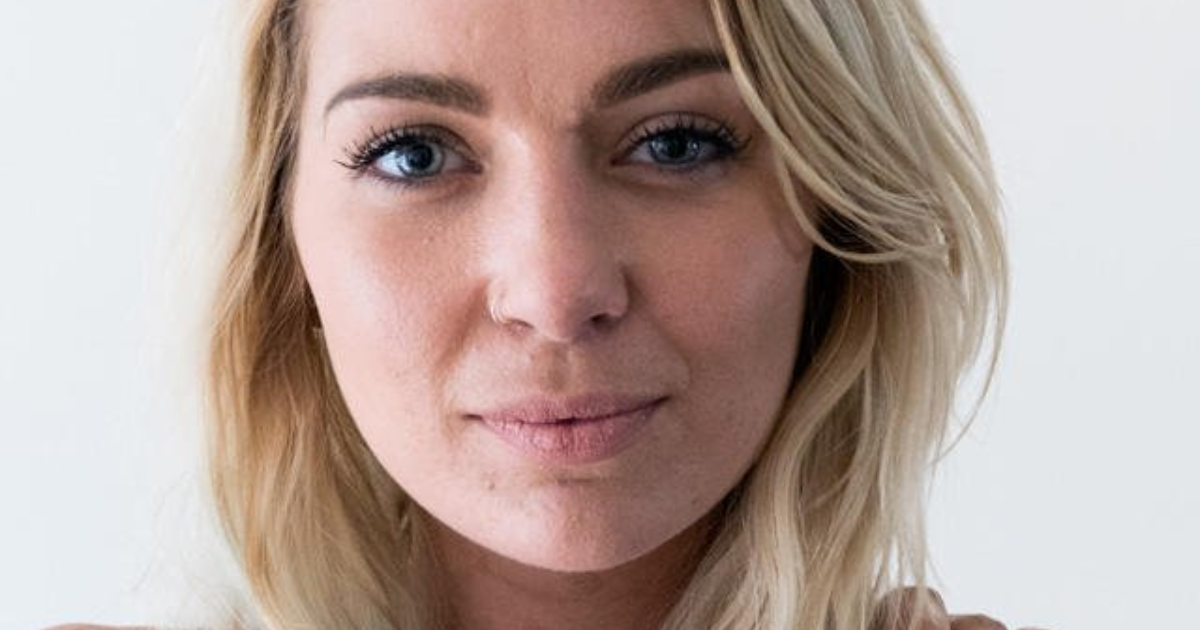 Dating mit einem mädchen mit psoriasis