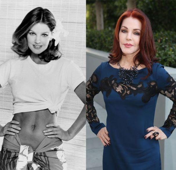 Successful Plastic Surgeries On Women