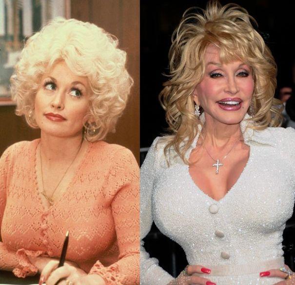 Successful Plastic Surgeries On Women