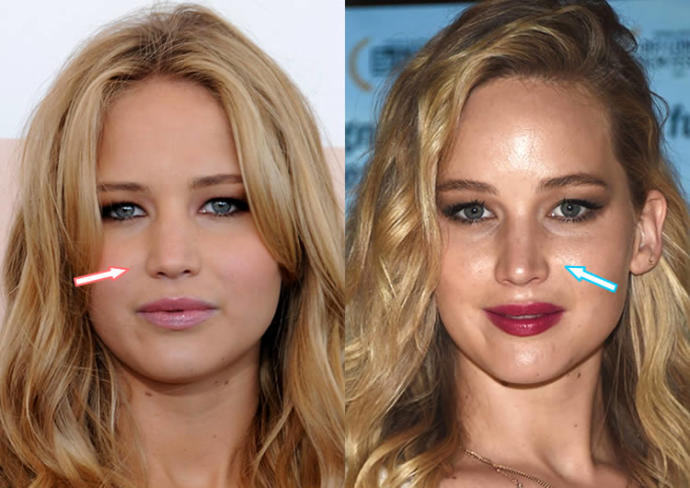 Successful Plastic Surgeries On Women
