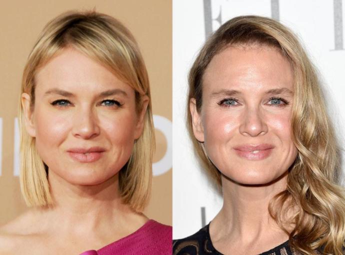 Successful Plastic Surgeries On Women