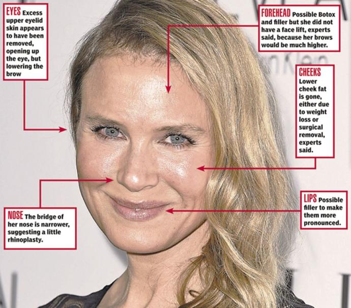 Successful Plastic Surgeries On Women