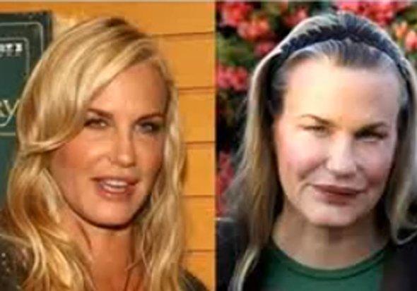 Successful Plastic Surgeries On Women