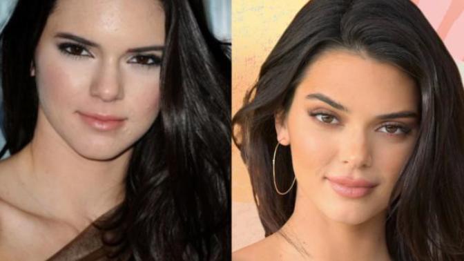Successful Plastic Surgeries On Women