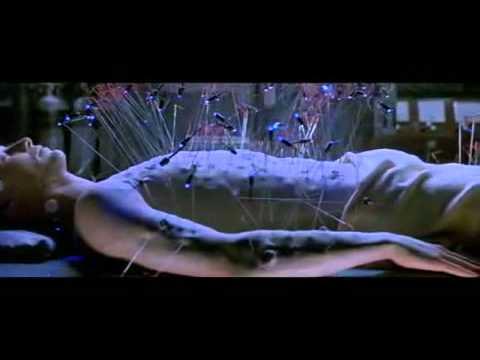 Monkeynutts discusses the merits of Acupuncture