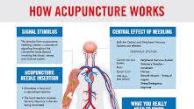 Monkeynutts discusses the merits of Acupuncture