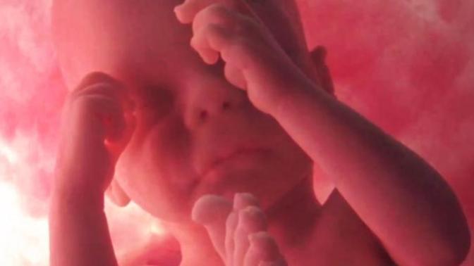 Why I recently became pro-life!