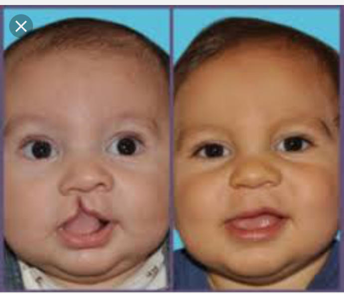 Why I don’t see anything wrong with plastic surgery