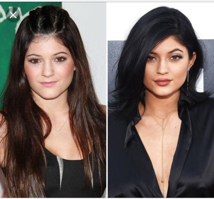 Why I don’t see anything wrong with plastic surgery