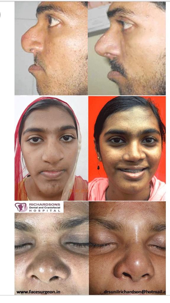 Why I don’t see anything wrong with plastic surgery