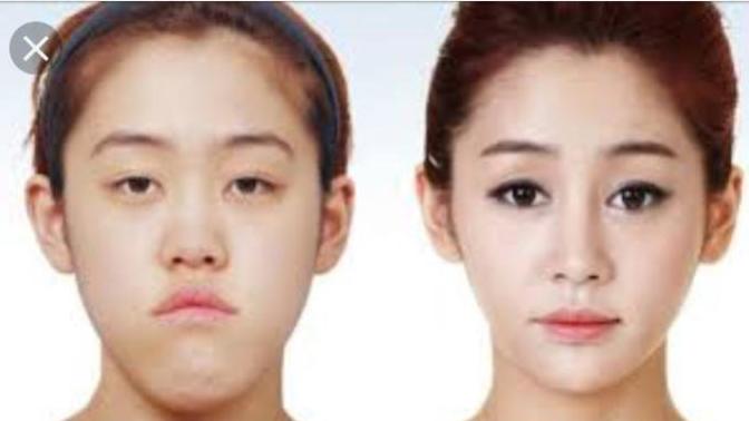 Why I don’t see anything wrong with plastic surgery