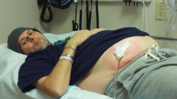 I am alive today because of an organ donor