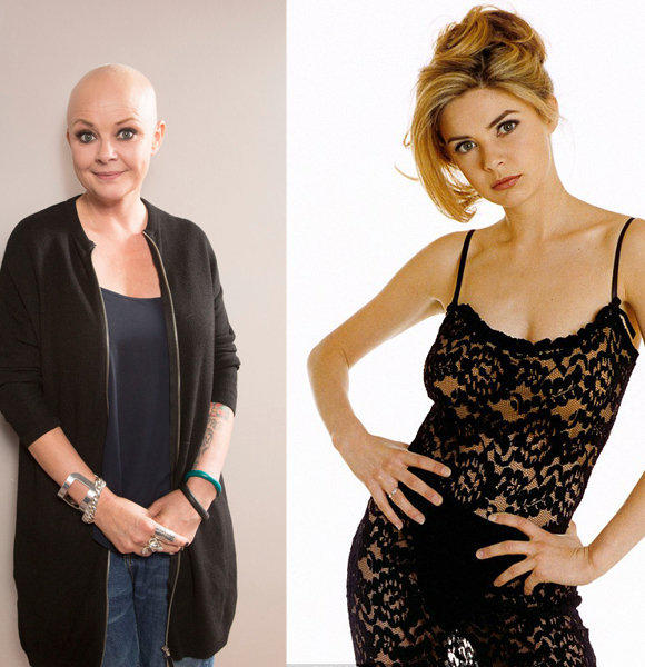 Nobody Likes a Bald Woman