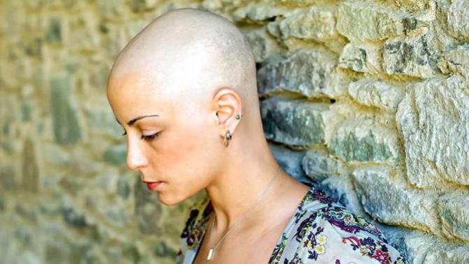 Nobody Likes a Bald Woman