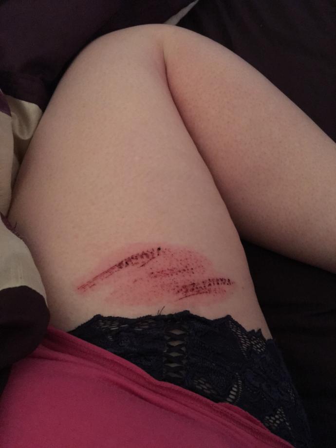 What The Point of Body Positivity Is