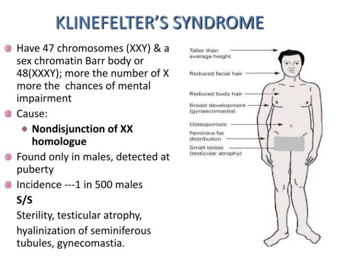 Have You Ever Heard Of Klinefelter Syndrome