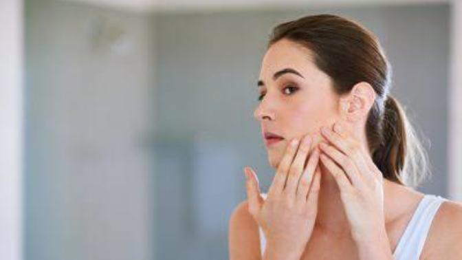 The Misery of Adult Acne