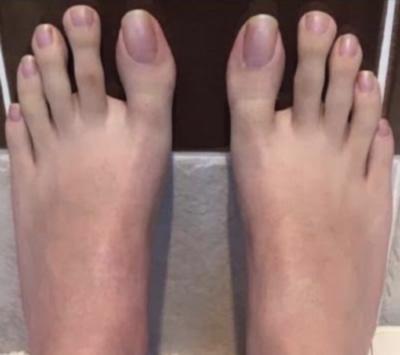 Foot care routine: 0-100 transformation (TL;DR included)