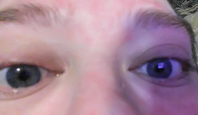 Blue eyes