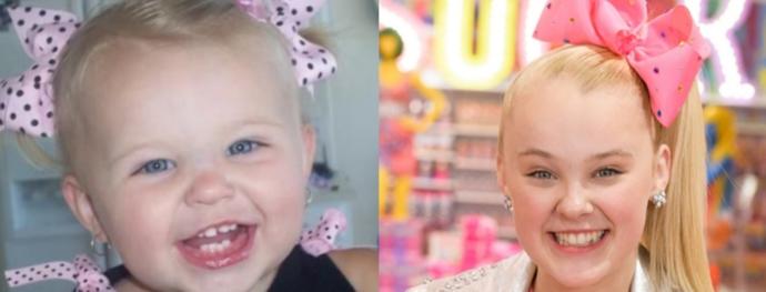 A NewBorn Baby's hairline represents how they will look in old age.
