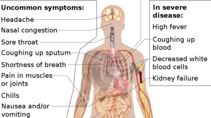 "Opening"Economy will get millions of people killed. Coronavirus