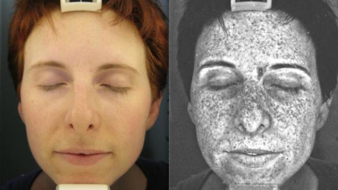 Tanning beds, tanning at the beach. Good for you or not?