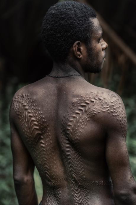 Tribal scars that have nothing to do with my story [Photo by Trevor Cole on Unsplash]